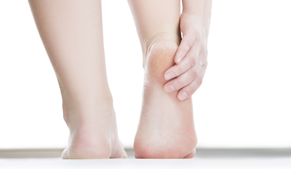 علاج تشقق القدمين