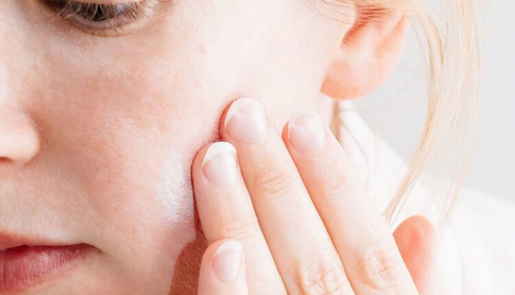 وصفة لتنظيف البشرة من الحبوب