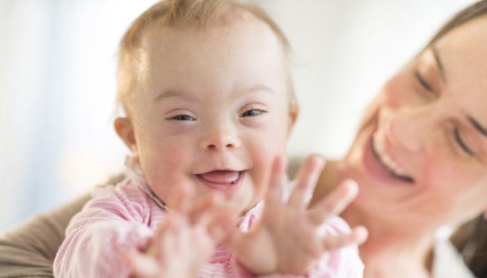 متى يبتسم طفل متلازمة داون وما هي أهم أعراض المتلازمة عند الأطفال وطرق الاكتشاف المبكر