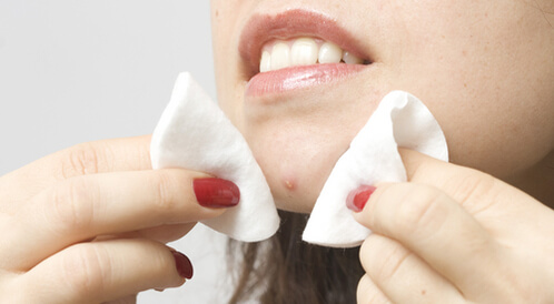 ماسك للوجه لإزالة الحبوب والبقع